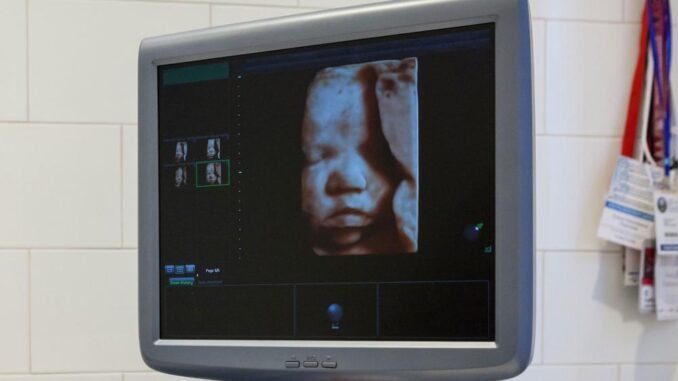ultrasoundunbornbabyfetus3_hdv